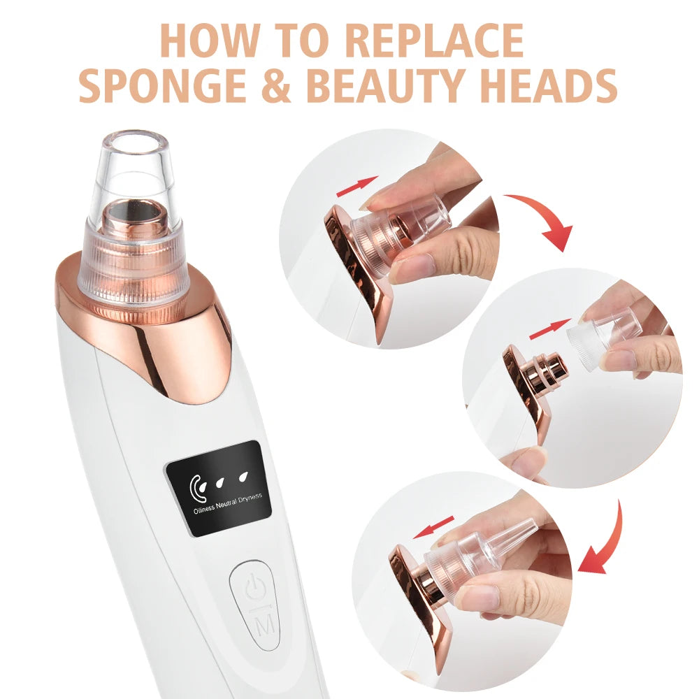 electric black head remover